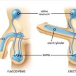 What Is ED Velsipity UC Treatment? Everything You Need to Know
