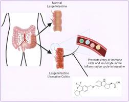 ED Velsipity UC Treatment FAQ: Your Top Questions Answered