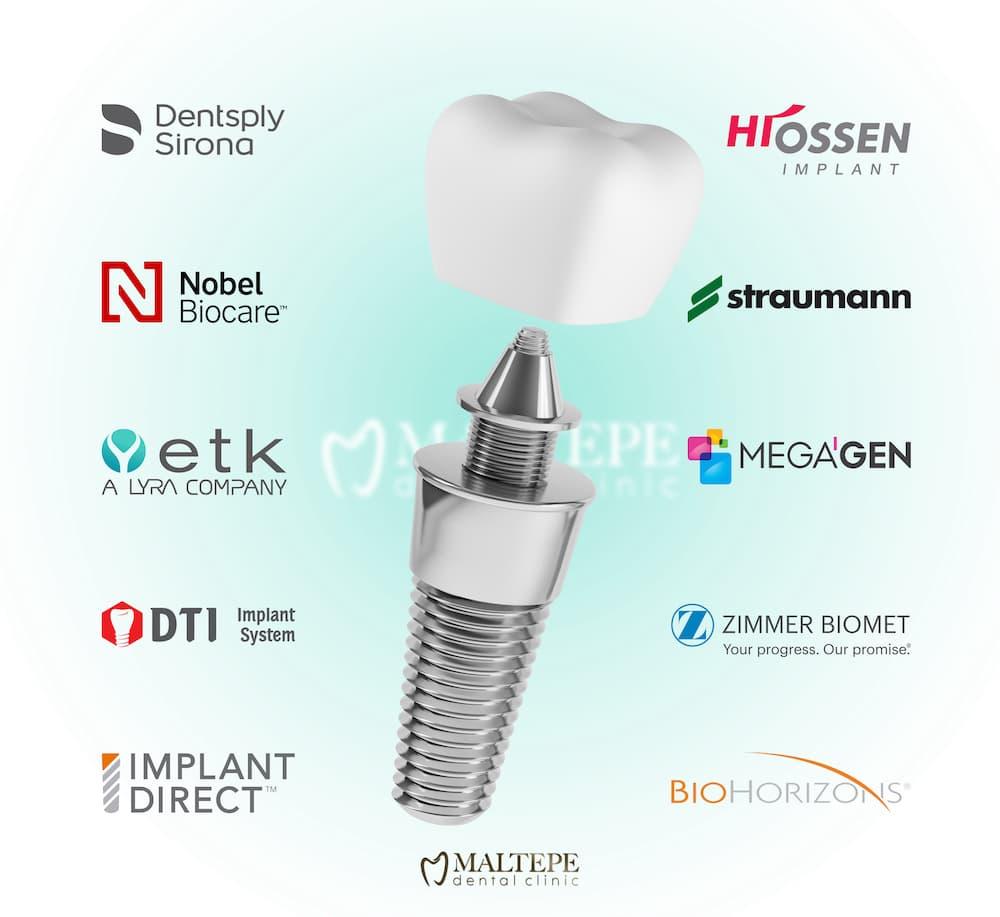 American vs. Korean Implant Brands: Which Should You Choose?