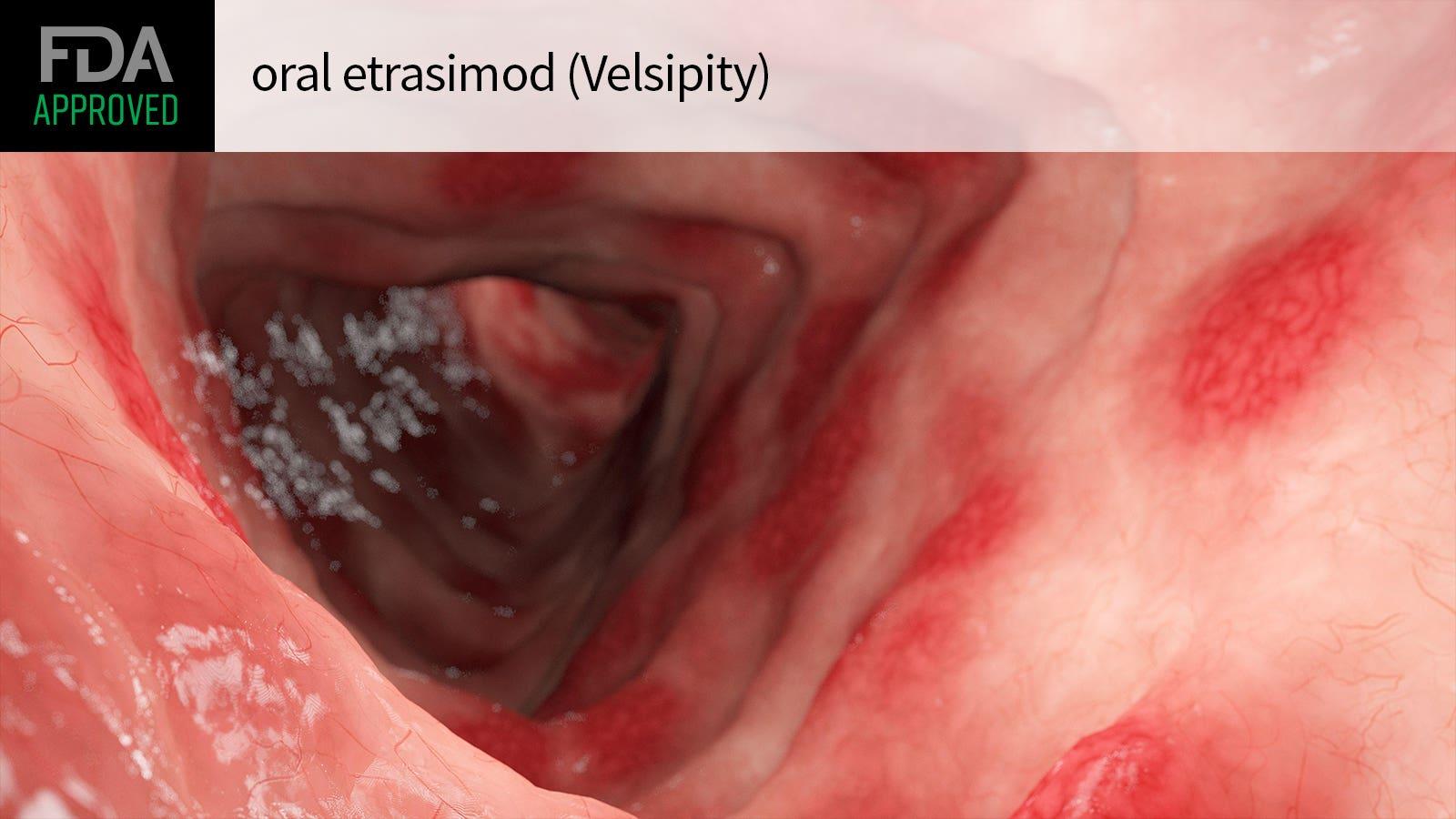 Understanding ED Velsipity UC Treatment Mechanism