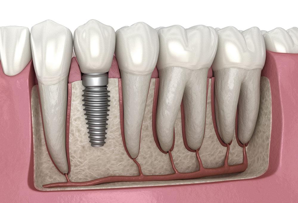 Expert Insights‌ from ⁢Leading ‌Dentists on ⁢Top Choices